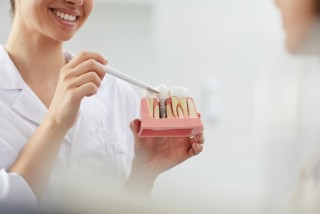 Dental Implant Services: Not Just For Senior Citizens